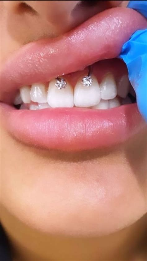 how long for smiley to heal|Important: Read This Before Getting Smiley Piercings